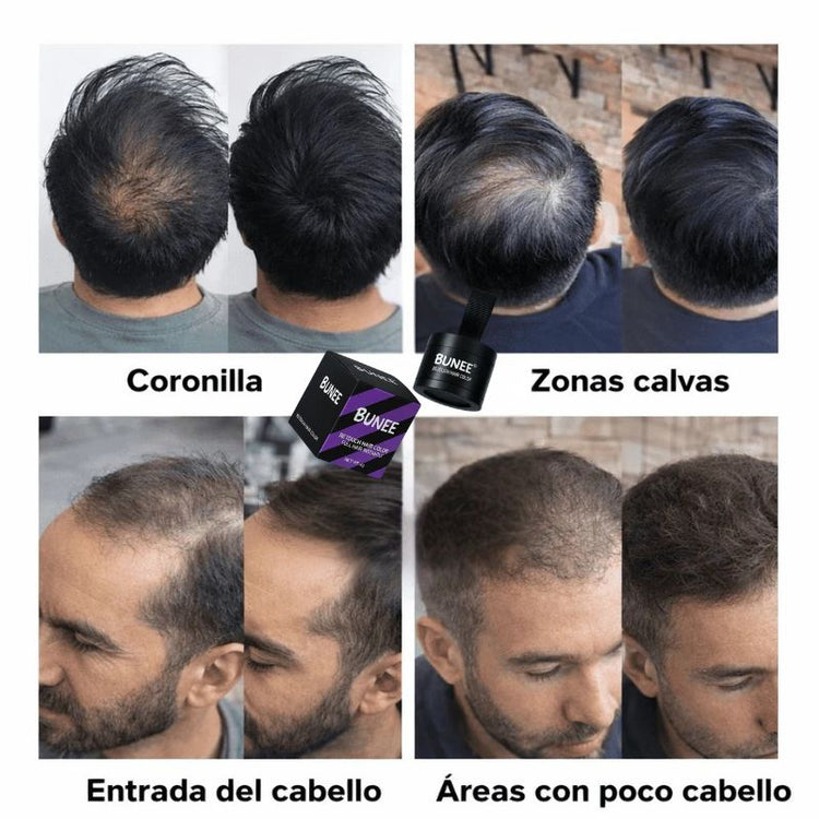 Resultados visuales de BUNEE en coronilla, entradas y zonas con poco cabello