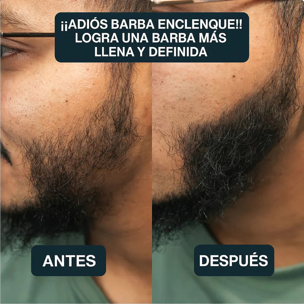 BUNEE® – Polvo Capilar Corrector Profesional Instantáneo