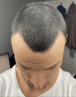 Resultado final con cabello de mayor densidad visual